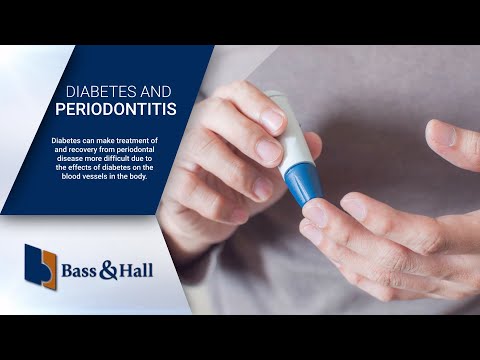 Periodontal Disease in Diabetics: Special Care Required
