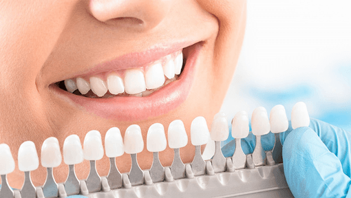 Choosing the Right Shade for Your Teeth Whitening