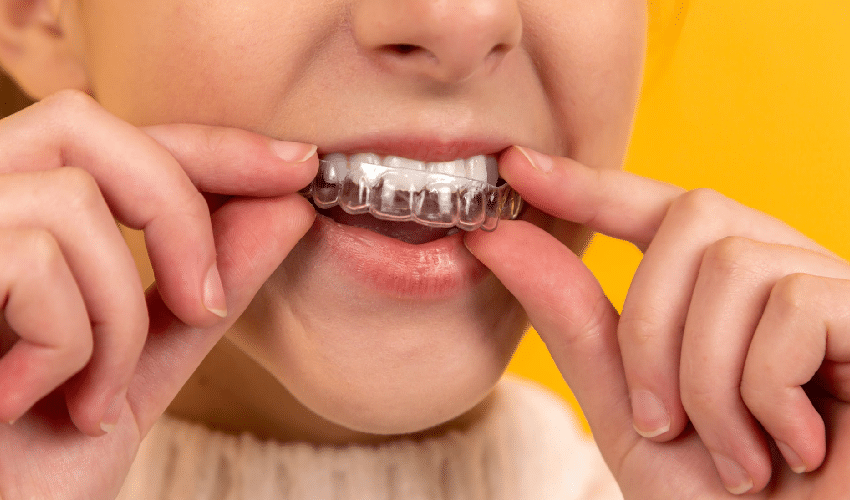 The Latest Innovations in Orthodontic Braces