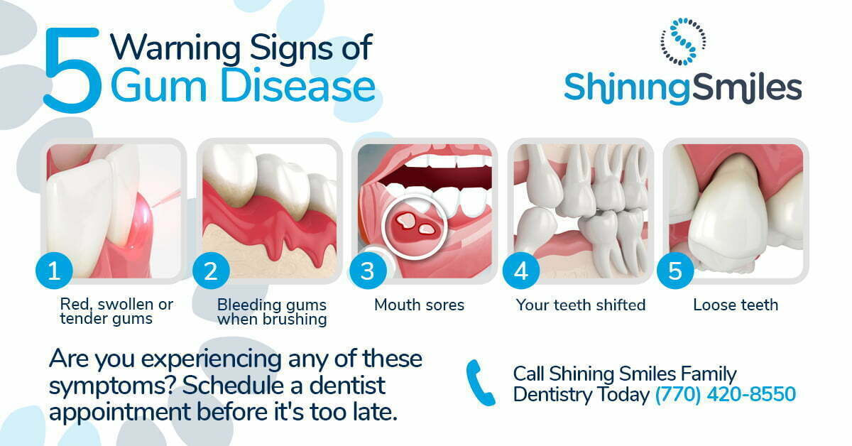 Early Detection and Management of Gum Disease
