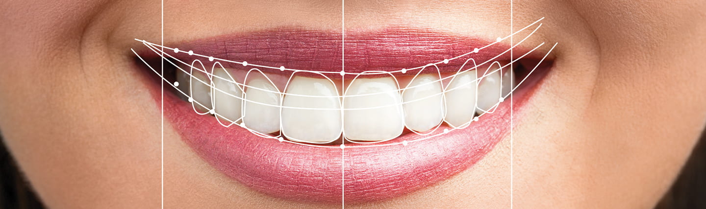 The Impact of Digital Smile Design on Cosmetic Dentistry