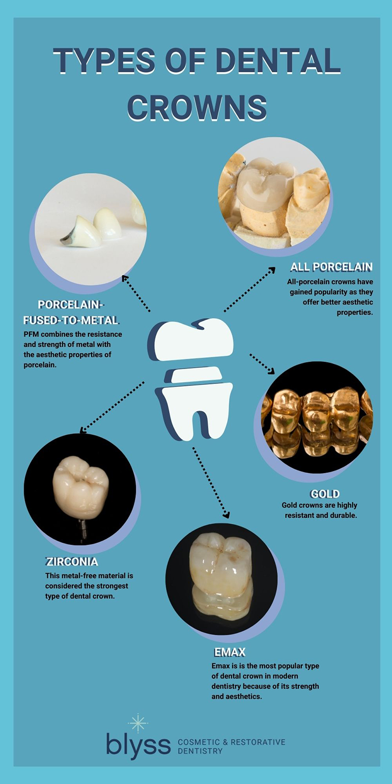 New Materials in Dental Crowns: Durability and Aesthetics