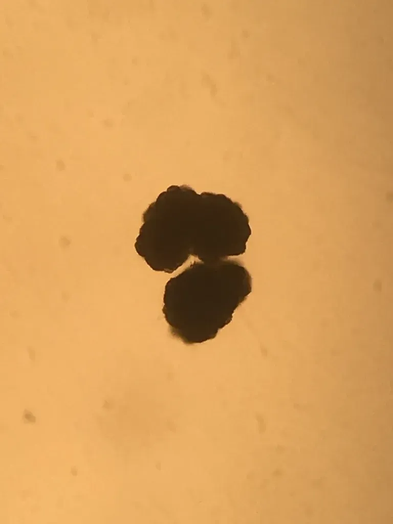 Botryococcus Braunii