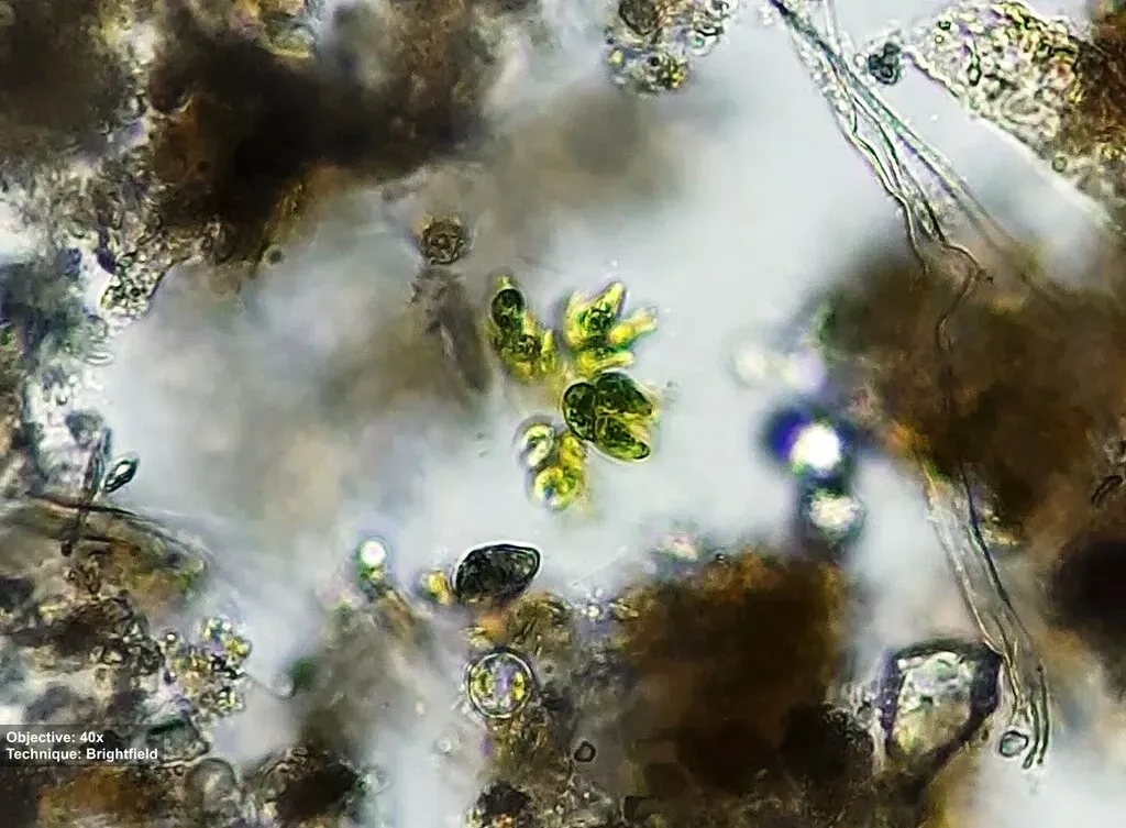 Kirchneriella Lunaris