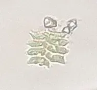 Tetradesmus Dimorphus