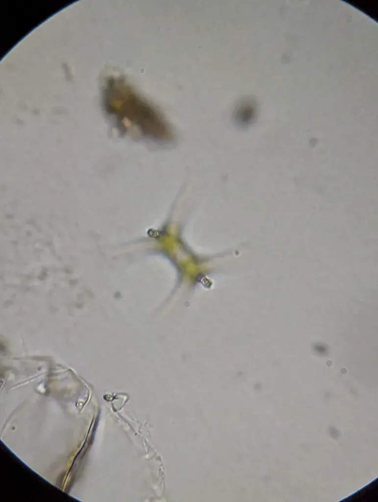 Staurastrum Johnsonii