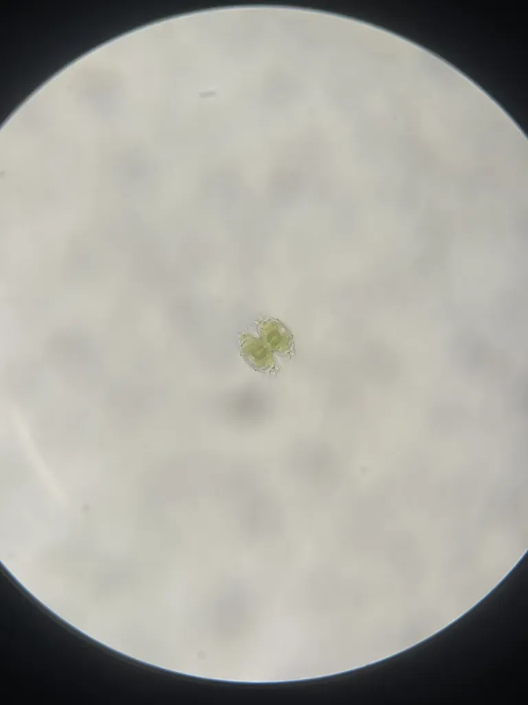 Staurastrum Gladiosum