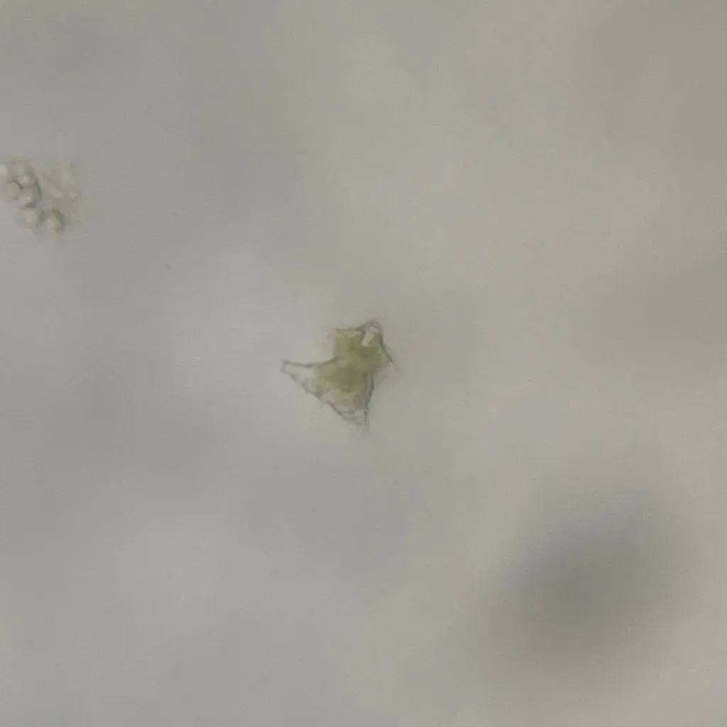 Staurastrum Cyrtocerum