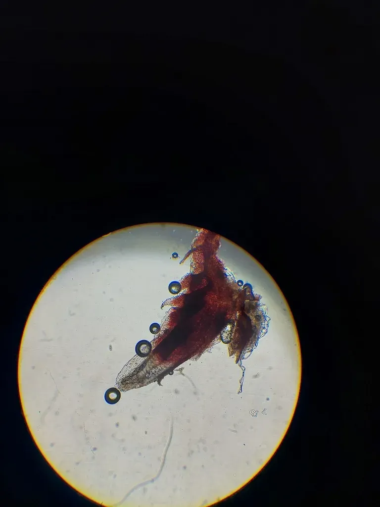 Cephaloziella Exiliflora