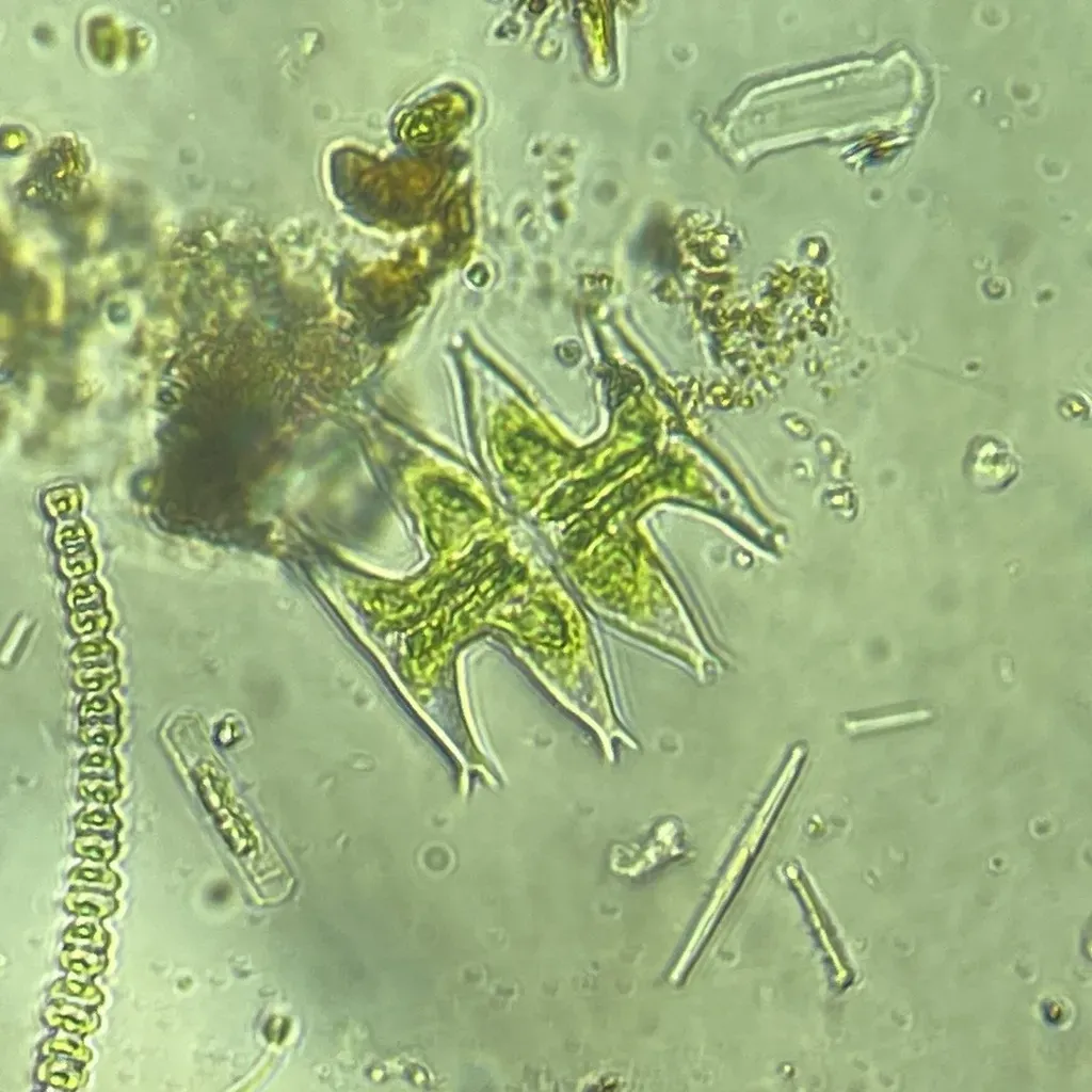 Micrasterias Pinnatifida