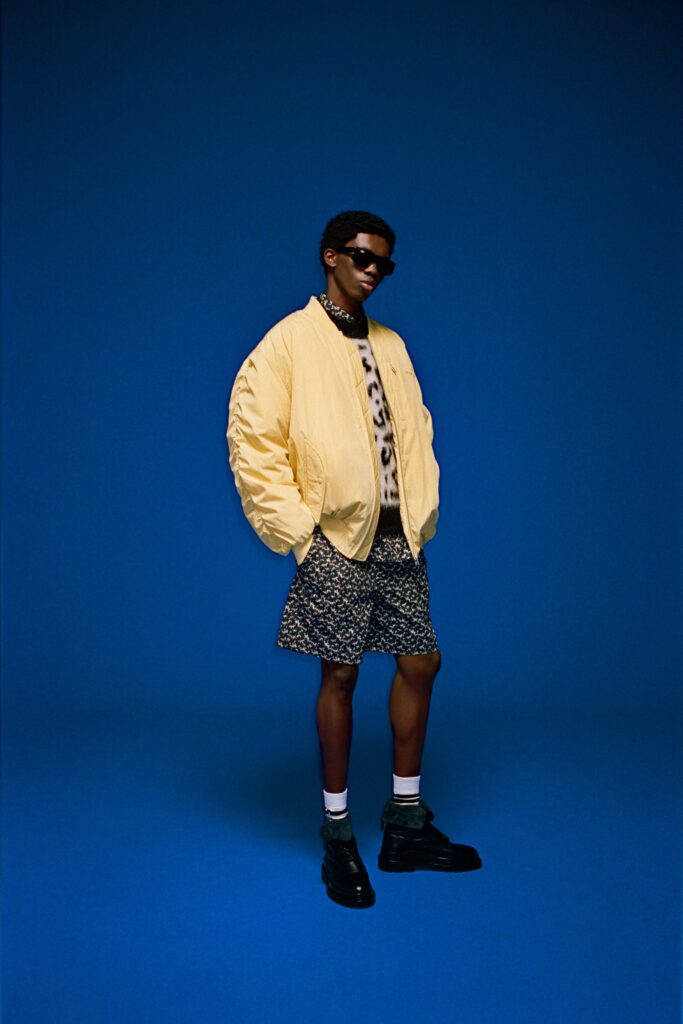 A relaxed yellow jacket paired with printed black shorts for a stylish look.