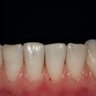 Teeth