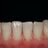 Teeth