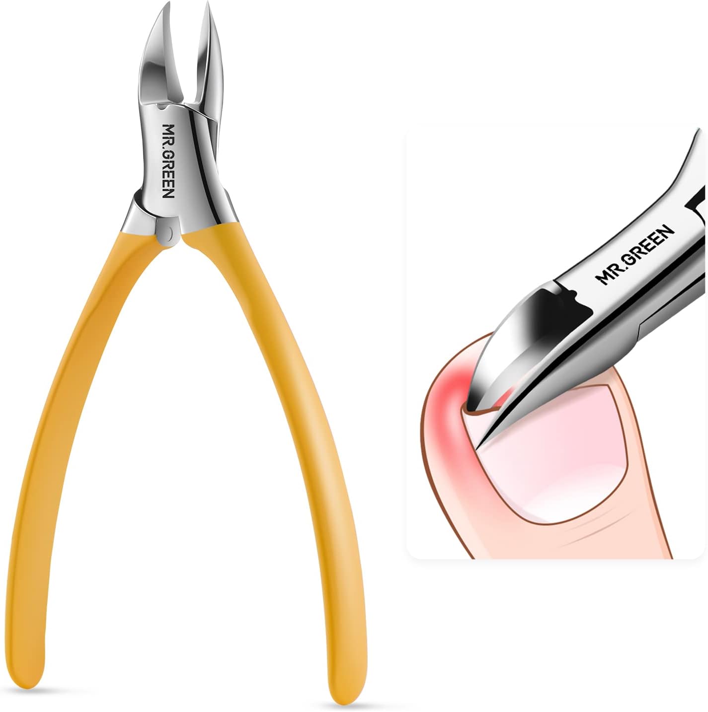 MR.GREEN Toenail Clippers Stainless Steel Ingrown Nail Cutter Thick and Hard Nails Pedicure Manicure Tools (Orange)